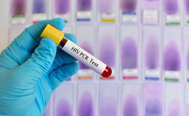 HIV PCR Test